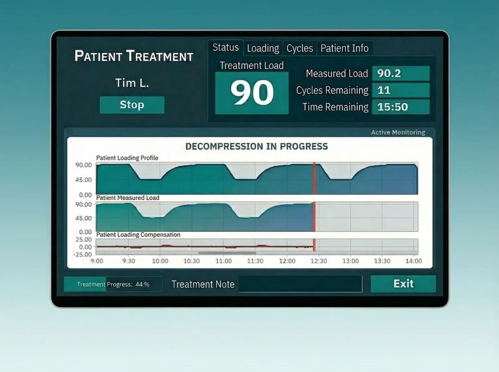 Pantalla de monitoreo del sistema de descompresión con curvas de fuerza